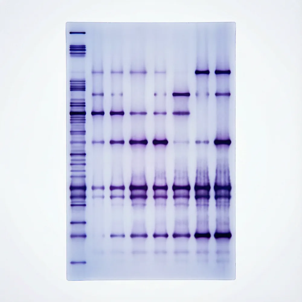 Fast Total protein-ABE Palmitoylation Kit For WB 快速全蛋白亚硝基免疫印迹法试剂盒